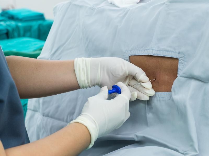 Reabilitação Pós-Cirúrgica da Coluna: O Caminho para a Recuperação Completa